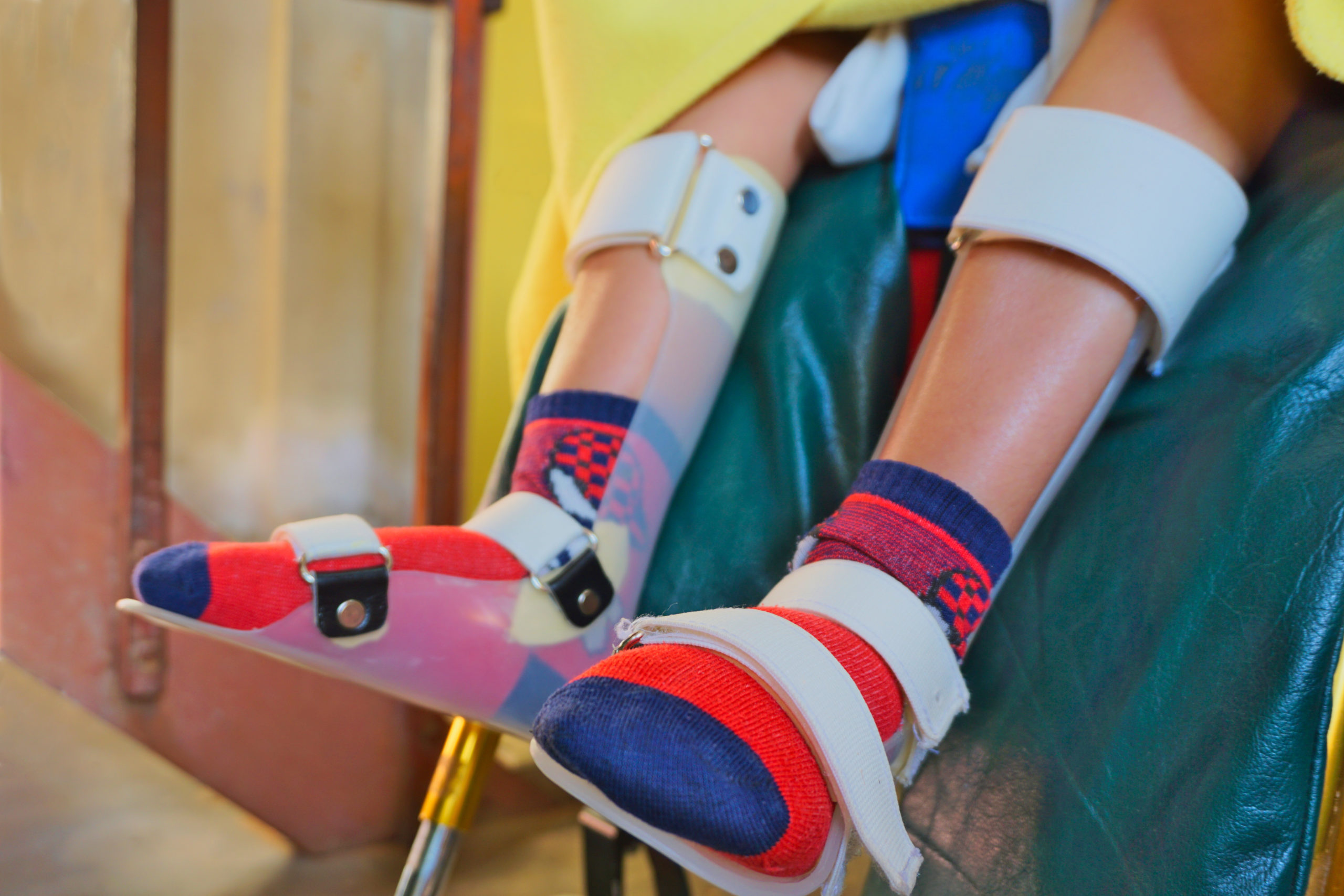 Orthotics – Prosthetics & Orthotics | CPO